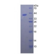 Pig Natriuretic Peptide Precursor B (NPPB) Protein