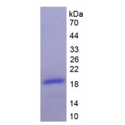 Rat Brain Natriuretic Peptide (BNP) Protein