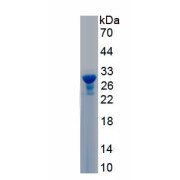 SDS-PAGE analysis of recombinant Human Matrix Metalloproteinase 25 (MMP25) Protein