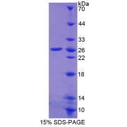 SDS-PAGE analysis of recombinant Human Phosphoserine Phosphatase (PSPH) Protein.