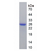 SDS-PAGE analysis of recombinant Human FTMT.