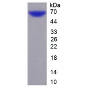 SDS-PAGE analysis of recombinant Human C22orf28 Protein.