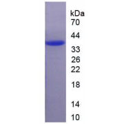 Human 11-Beta-Hydroxysteroid Dehydrogenase Type 2 (HSD11B2) Protein