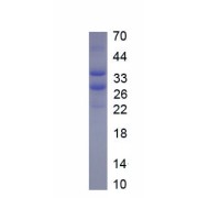 SDS-PAGE analysis of recombinant Rat A Disintegrin And Metalloproteinase With Thrombospondin 4 (ADAMTS4) Protein.