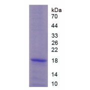 SDS-PAGE analysis of recombinant Human Calcium Channel, Voltage Dependent, N-Type, Alpha 1B Subunit (CACNa1B) Protein.