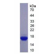 SDS-PAGE analysis of recombinant Human CNR1 Protein.