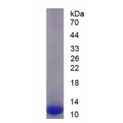 SDS-PAGE analysis of recombinant Human CLDN18.