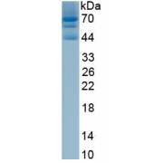 SDS-PAGE analysis of recombinant Human Collagen Type XII (COL12) protein.