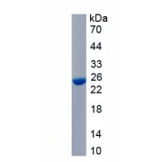 SDS-PAGE analysis of recombinant Rat Collagen Type XIX Alpha 1 (COL19A1) Protein.