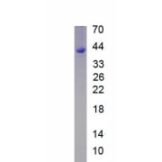 SDS-PAGE analysis of recombinant Cow Galectin 8 (LGALS8) Protein.