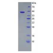 SDS-PAGE analysis of recombinant Mouse Heparan Sulfate Proteoglycan 2 (HSPG2) Protein.