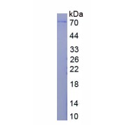 SDS-PAGE analysis of recombinant Mouse Histone Deacetylase 1 (HDAC1) Protein.