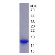 SDS-PAGE analysis of recombinant Human HAS2 Protein.