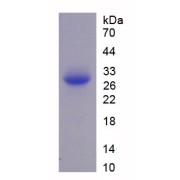 SDS-PAGE analysis of recombinant Human Multimerin 2 (MMRN2) Protein.