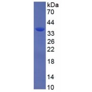 SDS-PAGE analysis of recombinant Human MYH6.