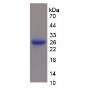 SDS-PAGE analysis of recombinant Human OPG Protein.