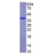 SDS-PAGE analysis of recombinant Rat ABCB1/Pgp Protein.