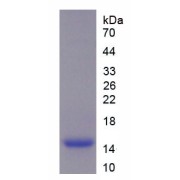 SDS-PAGE analysis of recombinant Human Secretory Leukocyte Peptidase Inhibitor (SLPI) Protein.