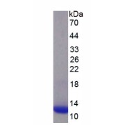 SDS-PAGE analysis of recombinant Human Synaptophysin (SYP) Protein.