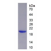 SDS-PAGE analysis of recombinant Human Tumor Susceptibility Gene 101 (TSG101) Protein.