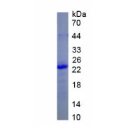 SDS-PAGE analysis of recombinant Human Fibroblast Growth Factor 11 (FGF11) Protein.