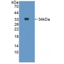 Human Hepcidin (HAMP) Protein (Active)