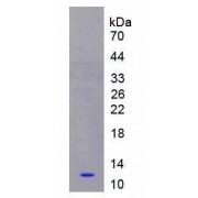 SDS-PAGE analysis of active recombinant Human S100A8.