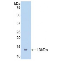 Human Protein S100-A8 / CAGA (S100A8) Protein (Active)