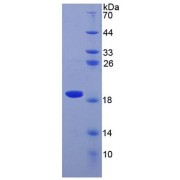 SDS-PAGE analysis of recombinant Human Superoxide Dismutase 1 (SOD1) Protein.
