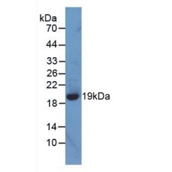 Human Heparanase (HPA) Protein (Active)