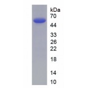 SDS-PAGE analysis of recombinant SARS-CoV-2 Spike Protein.