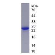 SDS-PAGE analysis of recombinant Human NEFL Protein.