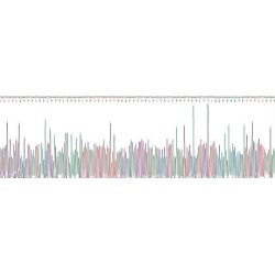 Human Selenoprotein P / SEPP1 (SELENOP) Protein