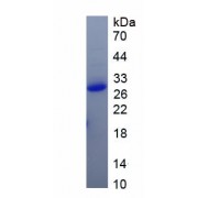 SDS-PAGE analysis of recombinant Pig Interleukin 2 Receptor Beta Protein.