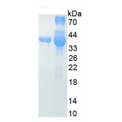 Dopamine (DA) (HSA)