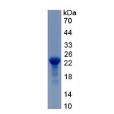 Rat Interleukin 11 (IL11) Protein (Biotin)