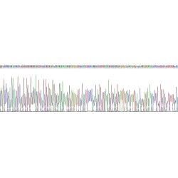 Human Sphingomyelin Phosphodiesterase (SMPD1) Protein (Active)