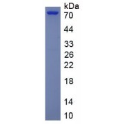 SDS-PAGE analysis of recombinant Human ASM/SMPD1 Protein.