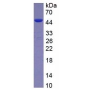 SDS-PAGE analysis of recombinant Human ASM/AST Protein.