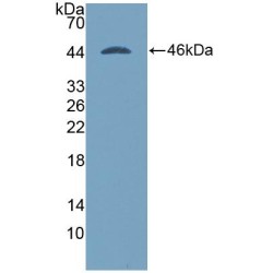 Human Aspartate Aminotransferase (AST) Protein (Active)