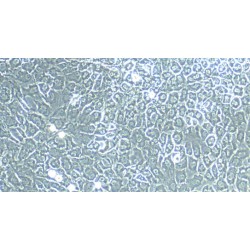 Pig Articular Chondrocytes (AC)