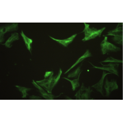 Immunofluorescence identification of Vimentin.