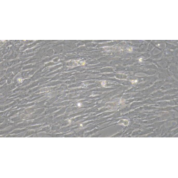 Rat Thyroid Fibroblasts (TF)