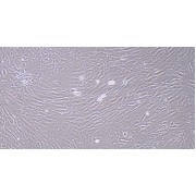 Morphology of Rat Corpus Cavernosum Smooth Muscle Cells (100X).