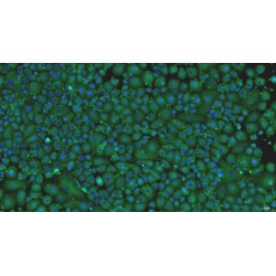 Rat Pericardial Mesothelial Cells (PeMC)