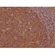 IHC-P analysis of human tonsil tissue, using GNLY Antibody (1/200 dilution).