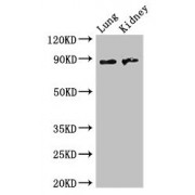 WB analysis of mouse lung and mouse kidney, using NAALADL2 antibody (3.5 µg/ml). Predicted band size: 37, 89 kDa, Observed band size: 89 kDa.