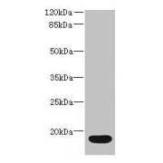 WB analysis of Mouse stomach tissue, using Interleukin-36 Receptor Antagonist Protein (IL36RN) Antibody (16 µg/ml). Predicted band size: 17 kDa and Observed band size: 17 kDa.