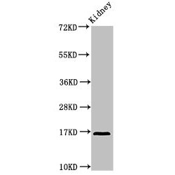 Interleukin-36 Receptor Antagonist Protein (IL36RN) Antibody