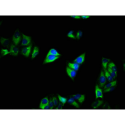 Calcium Voltage-Gated Channel Auxiliary Subunit Alpha-2/Delta-1 (CACNA2D1) Antibody